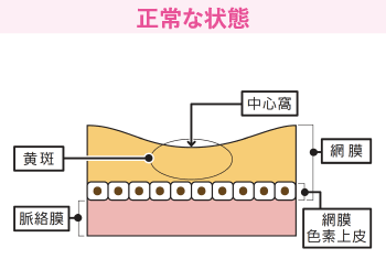 正常な状態