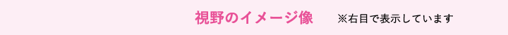 視野のイメージ像